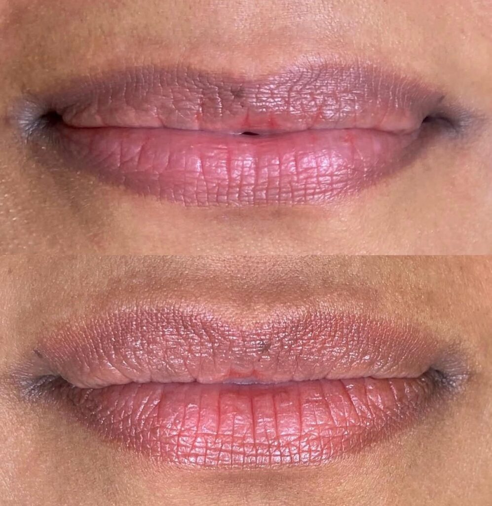 Before and after dark lip neutralisation at Laelia Brows in Beaumaris, fully healed after one session, with purple tones cancelled out to create an even colour throughout.